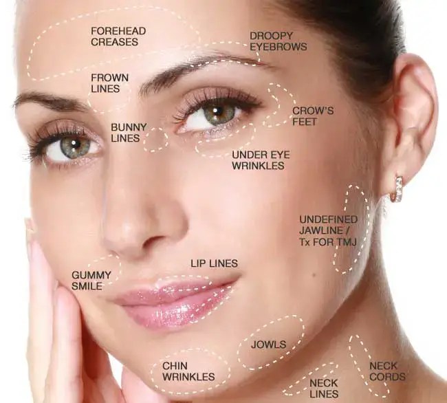Botox Miami, botox cerca de mí, costo de dysport miami, costo de botox, medspa cerca de mí, costo de botox miami, botox más barato miami, dysport más barato miami